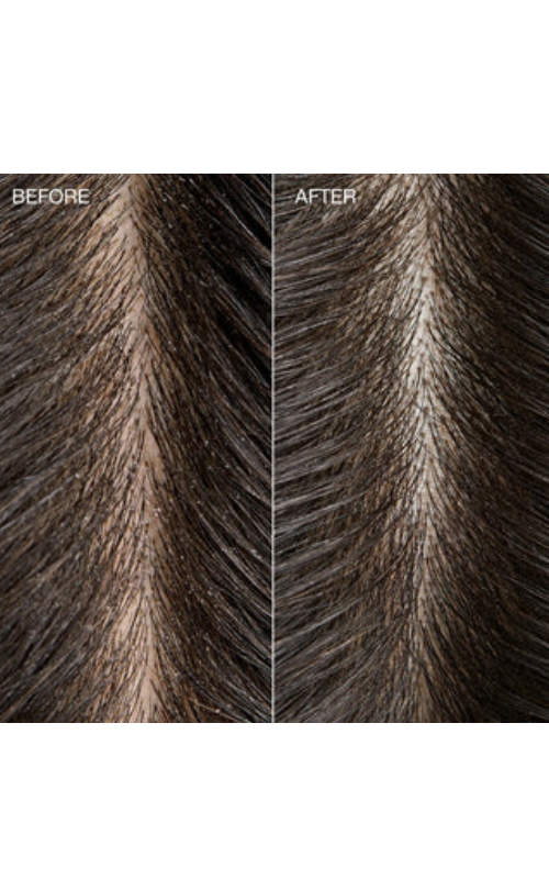 悅活康普茶菌淨化液Tea Tree Special Detox Kombucha Rinse